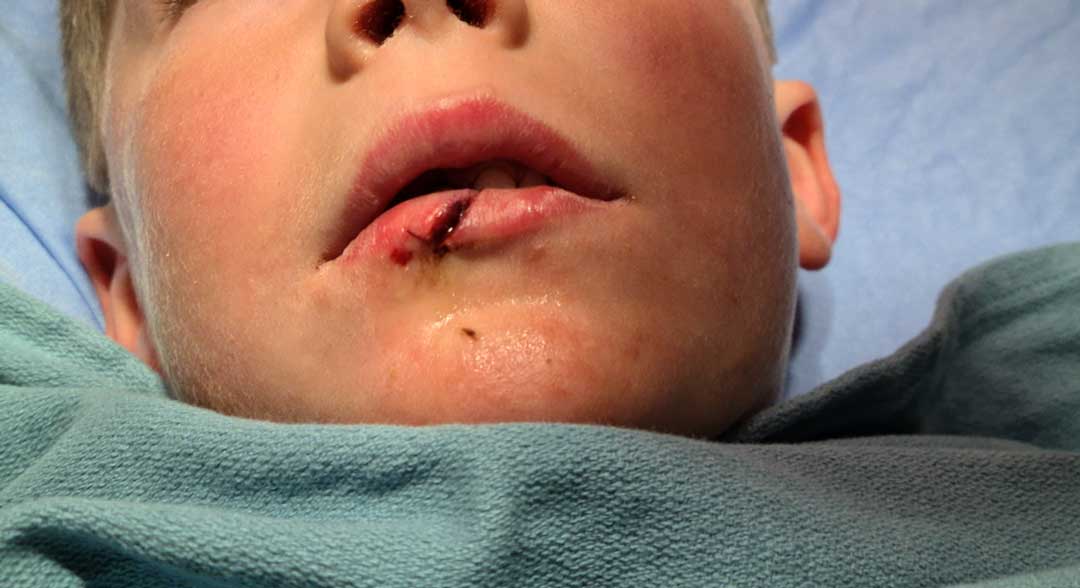 SUTURED in Winnipeg, MB (November 15, 2025)