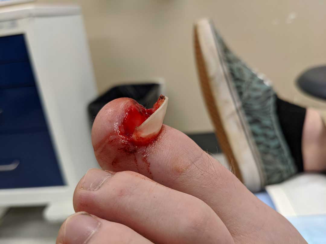 Sutured in Saskatoon, SK (November 14, 2026)