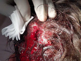SUTURED in Vancouver, BC (February 17, 2024)
