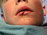 SUTURED in Vancouver, BC (February 17, 2024)