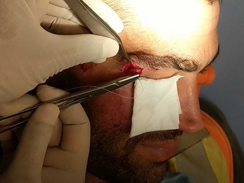 SUTURED in Vancouver, BC (February 17, 2024)