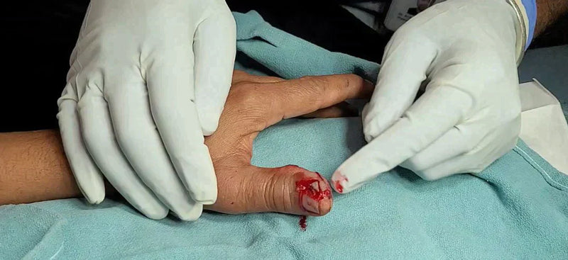 MedicalEd SUTURED course for finger injuries