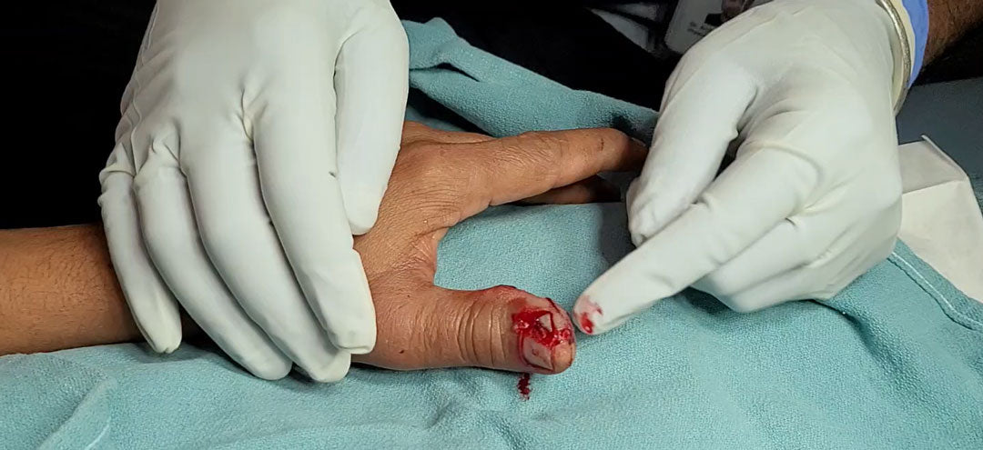 Sutured in Saskatoon, SK (November 14, 2026)