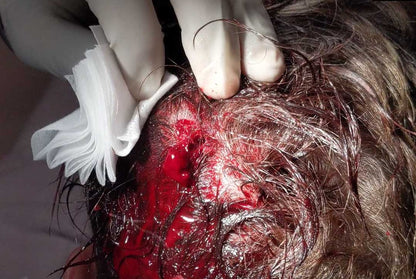 Sutured in Saskatoon, SK (November 14, 2026)